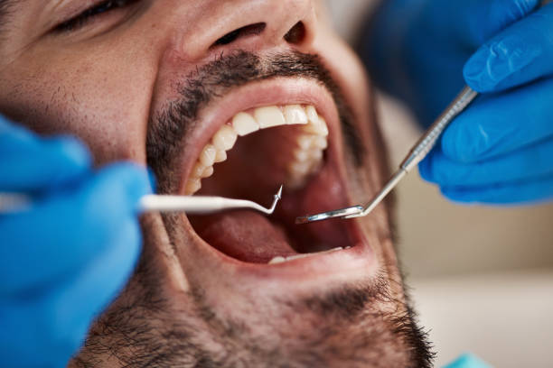 Best Broken Tooth Emergency  in Butler, WI